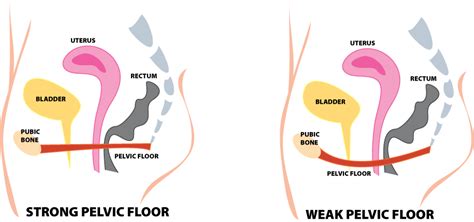 Womens Health And Pelvic Floor Rehabilitation Hamilton Physical