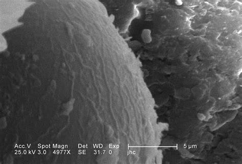 Free Picture Ultrastructural Morphology Head Region Larval Antlion