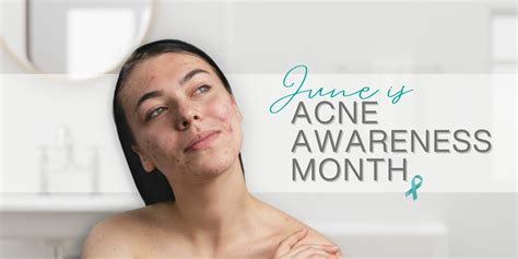 Embrace Your Skin Embrace Yourself Temple Skincare And Spa Celebrates Acne Awareness Month The