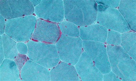 Journal of Cellular Signaling | Home Page 