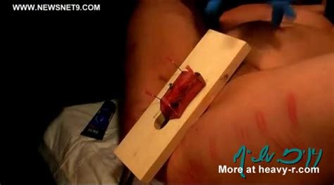 Extreme Pussy Torture With Screws And Needles ThisVid