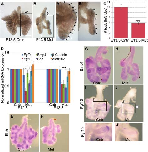 Branching Morphogenesis And Fgf Signaling Pathway Were Inhibited In