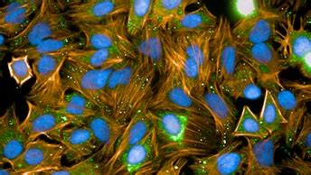 cellular   vivo imaging solutions revvity