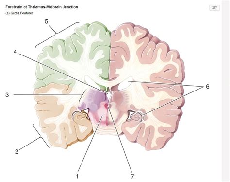 NEUR170 Ch 7 Forebrain At Thalamus Midbrain Junction Diagram Quizlet