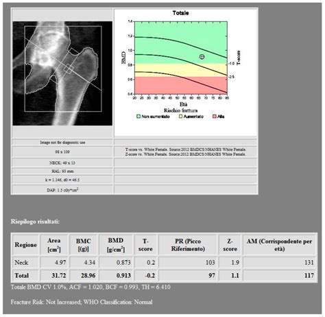 bone mineral density bmd assessment  dual energy ct