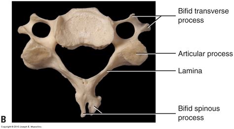 Introduction To Overview Of The Cervical Spine Of The Neck