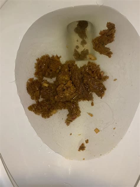 Why Does My Poop Look Like Tar at Austin George blog