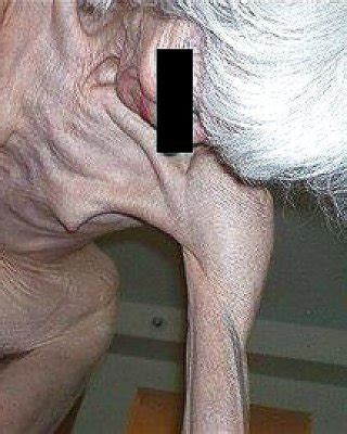 EXTREMELY SKINNY AND VERY OLD HAIRY GRANNY Porn Pictures XXX Photos Sex Images 907102 PICTOA