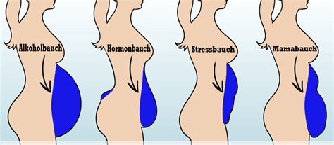 Bauchtypen Und Wie Man Sie Loswird Hogmag