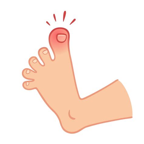 Relief From Big Toe Pain - Health Tips From The Professor