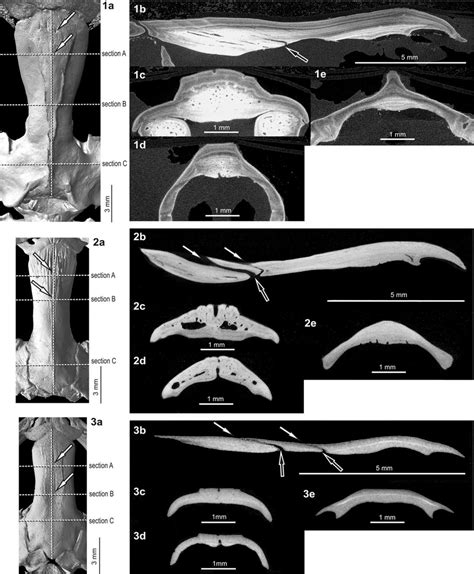 Developmental changes in the external morphology and inner structure of ...