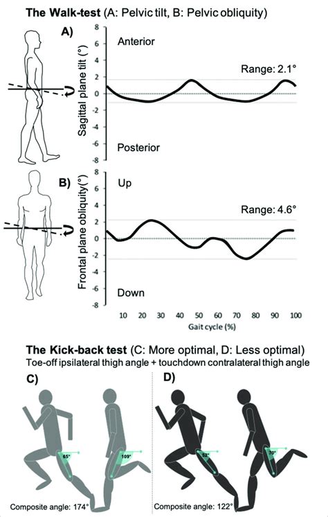 Lumbopelvic Control Tests The Walk Test A B Is Based On A Composite