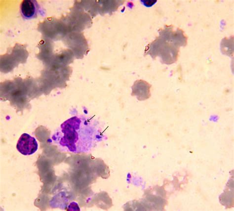 Leishmania Amastigotes In Intracellular Revealed In A Giemsa Stained