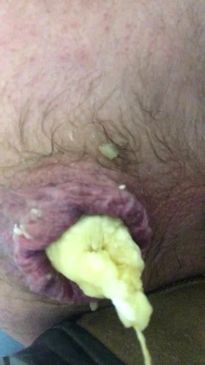 Banane Dans Le Cul Free Gay Amateur HD Porn Video Ca XHamster