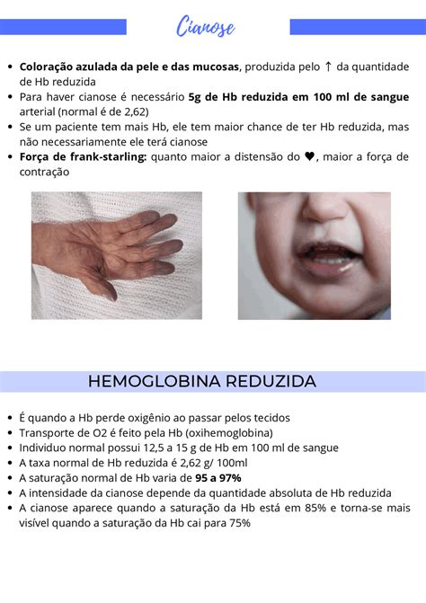 Cianose: o que é e suas características | Esquemas Semiologia | Docsity