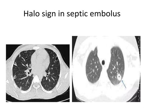 Halo Signppt