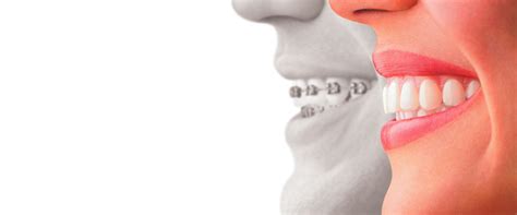The Best Dentist In Toluca Lake My Dentist Toluca Lake
