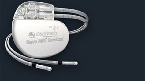 Pacemaker can be used in MRI machines | wthr.com