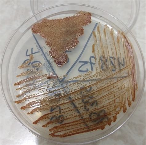 Bioquímica Diagnóstica BQD-YAI: Candida albicans