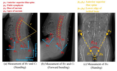 Modeling Joint Stiffness Change by Pelvic Tightening Based on Pelvic