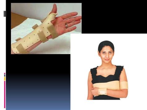 Basic Fracture Management Ppt