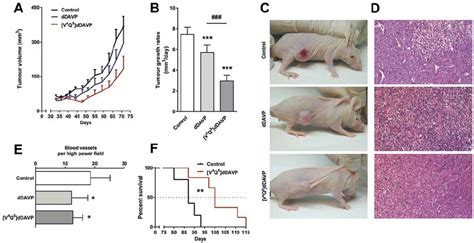 Effect Of V 4 Q 5 DDAVP On Tumour Progression Of Human Breast Cancer