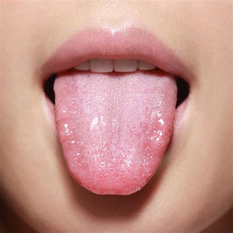 What Your Tongue Can Tell You About Your Health Chatelaine