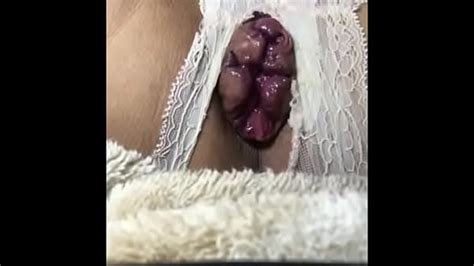 Crossdreser Anal Speculum Xxx Mobile Porno Videos Movies IPornTV Net