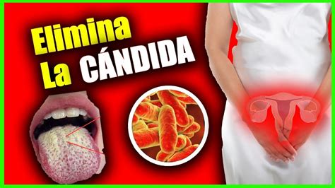 Como Evitar A Candida - Cómo Eliminar la Cándida.Cómo evitar y tratar la candidiasis. - YouTube