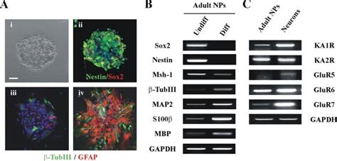 Characterization of adult neural progenitors and kainate receptor ...