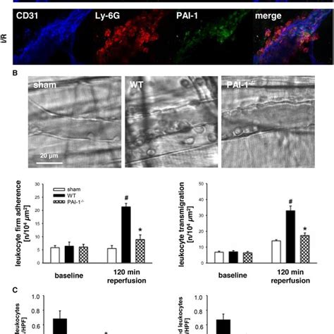 Role Of Plasminogen Activator Inhibitor Pai For Postischemic