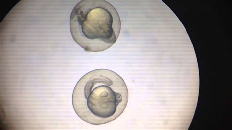 Zebrafish Embryo Development 24hours YouTube