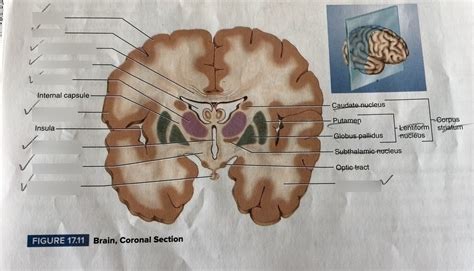 Brain Coronal Section Diagram Quizlet