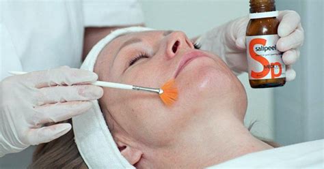 Салициловый пилинг кожи лица : описание, противопоказания, уход, фото ...