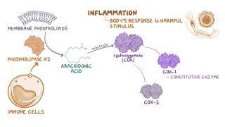 Tietze Syndrome: What Is It, Causes, Treatment, and More | Osmosis