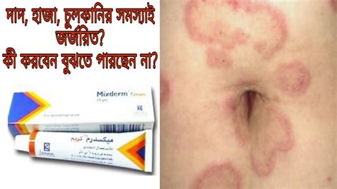 Mixderm Cream Uses Benefits And Side Effects Full Review Youtube