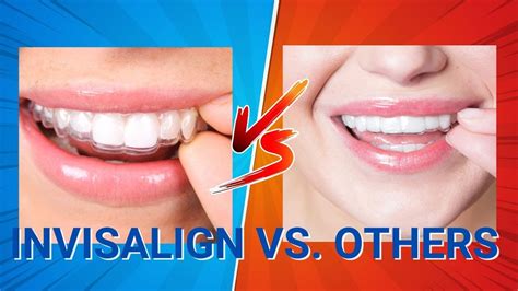 Invisalign Vs Other Clear Aligners Youtube