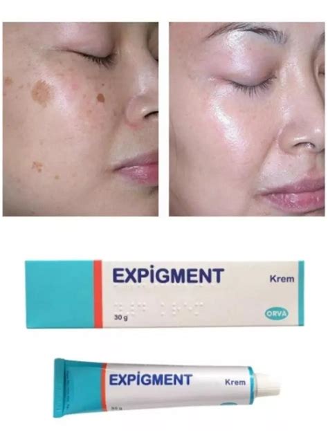 Expigment 4% Krem Wybielający na Przebarwienia 30G | Sandomierz | Kup ...