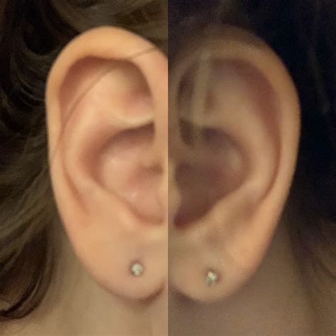 New Piercings Uneven Is It Worth It To Get Them Fixed If I Plan On