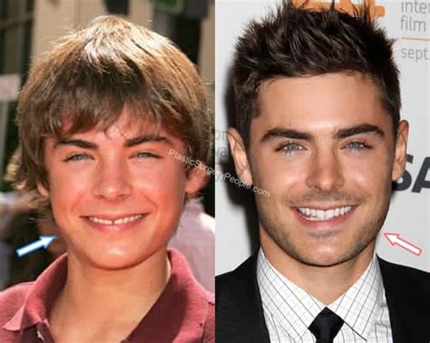 Zac Efron, Before and After 2020