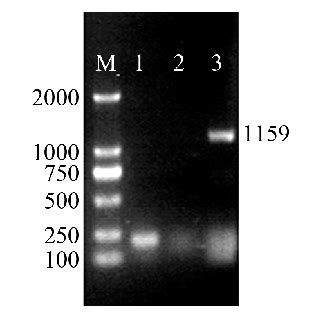 Electrophoresis of PCR product of LEF-1 M: DL2000 marker; 1: Positive ...