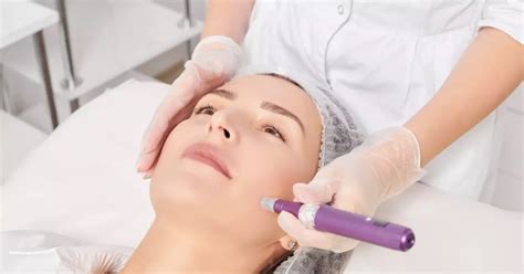 Side Effects of Microneedling | Inner Ocean Center for Healing