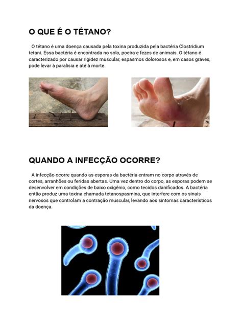 Como Fica A Ferida Do Tétano - Tétano: Sintomas, Tratamento e Prevenção | PDF | Remédio ...