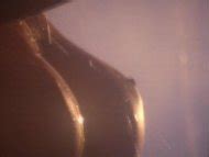 Michelle Grassnick nude pics página