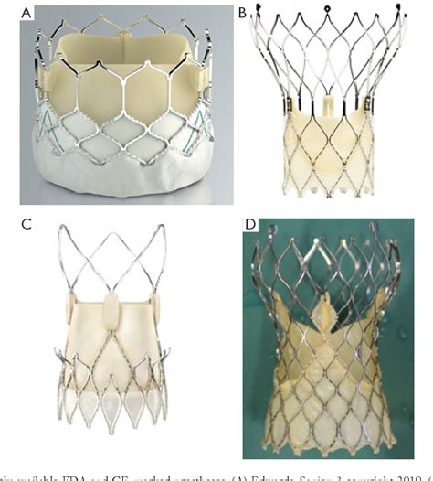 figure   current issues  transcatheter aortic valve replacement