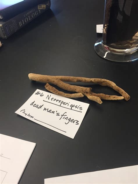 Dead Man's Fingers Diagram | Quizlet