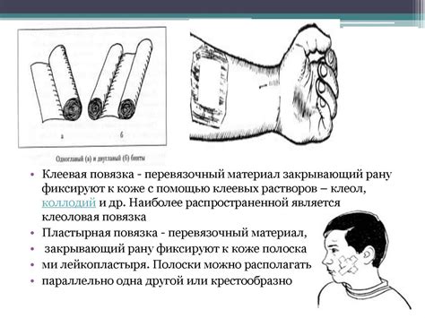 Основы десмургии - презентация онлайн