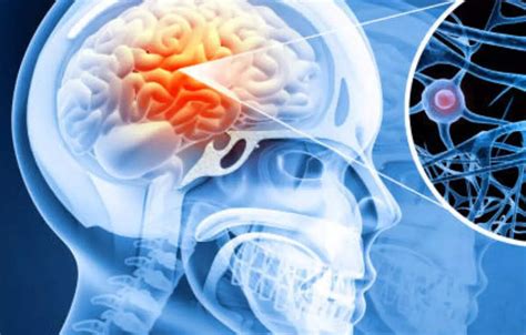 study  insight  predicting neurodevelopmental disease