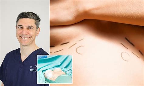 British Girl 15 Sneaks Off To Turkey For A BOOB JOB Behind Her