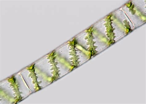 spirogyra filament